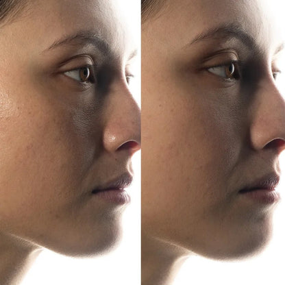 T32 - Poudre libre matifiante Zinc PCA 1%