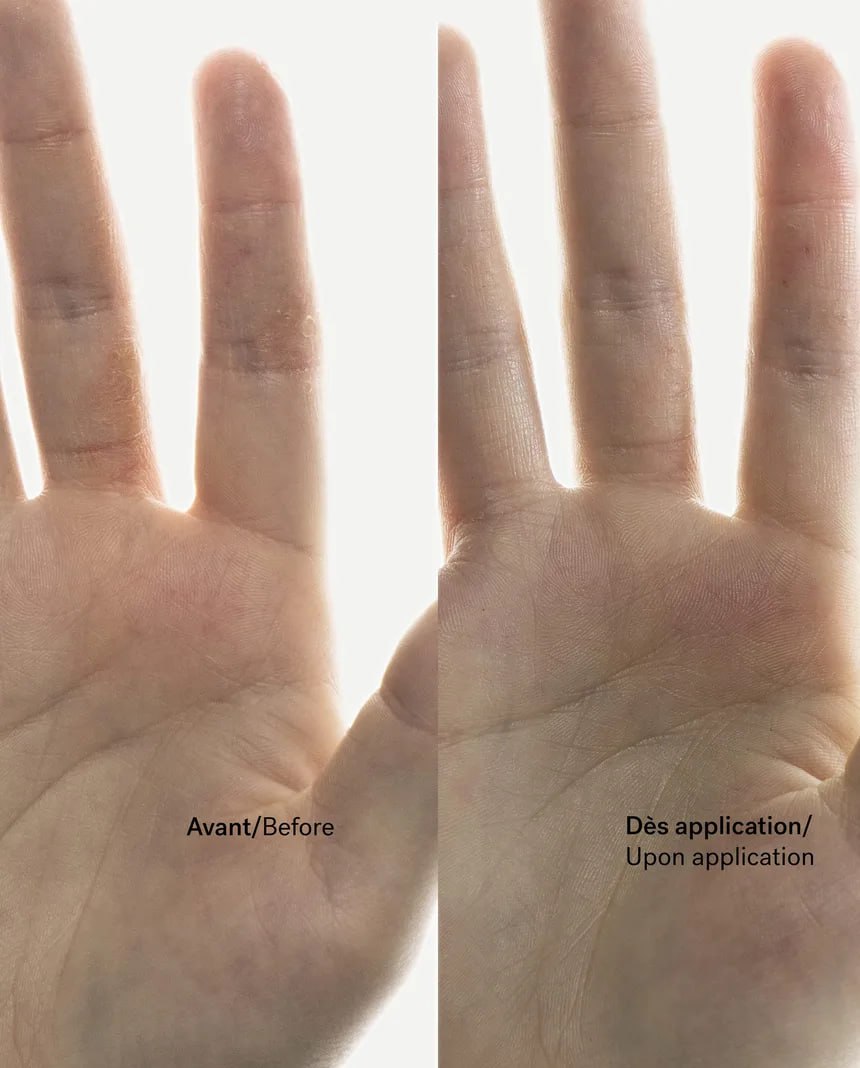 C93 - Crème anti-démangeaisons Énoxolone 0,15% + Bisabolol