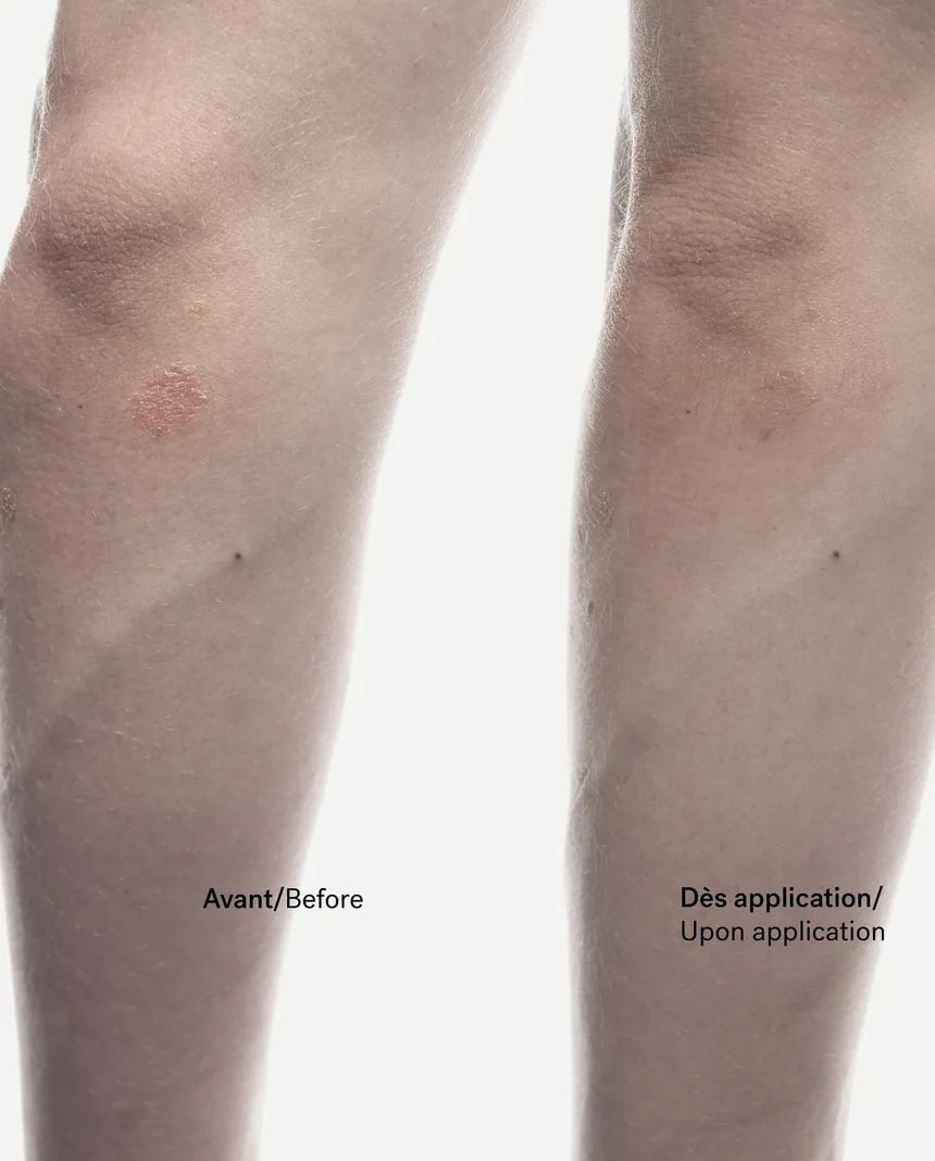 C92 - Crème anti-squames Phytostérols 1% + Allantoïne